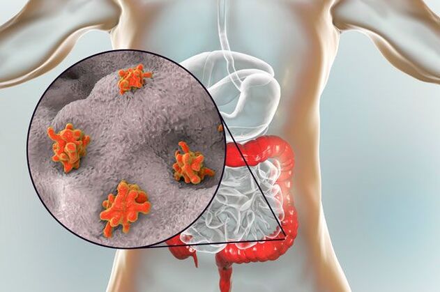 tipos de parásitos en el cuerpo humano