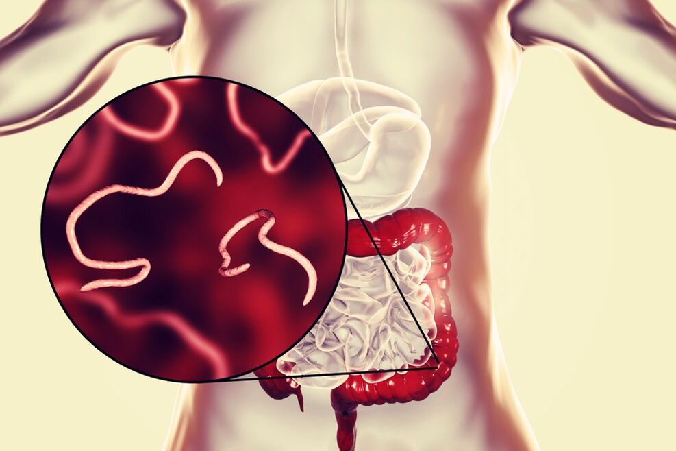 gusanos en el intestino humano